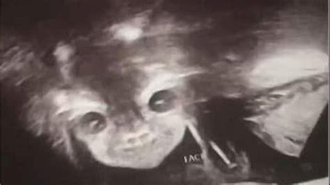 Demon Baby Shocks Parents In Hilarious Ultrasound Pics Fox News