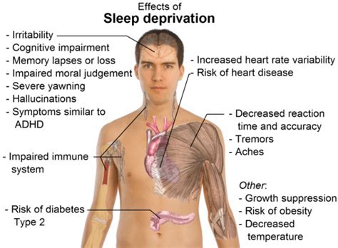 Check spelling or type a new query. Coach Mental Poker : gérer son sommeil | PokerNews