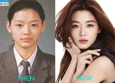 Korean Actors Before And After Plastic Surgery Korean Actorsactresses