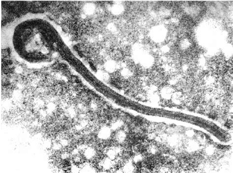 Or perinatally during pregnancy, childbirth or breastfeeding. The first electron micrograph of a Marburg virion from ...