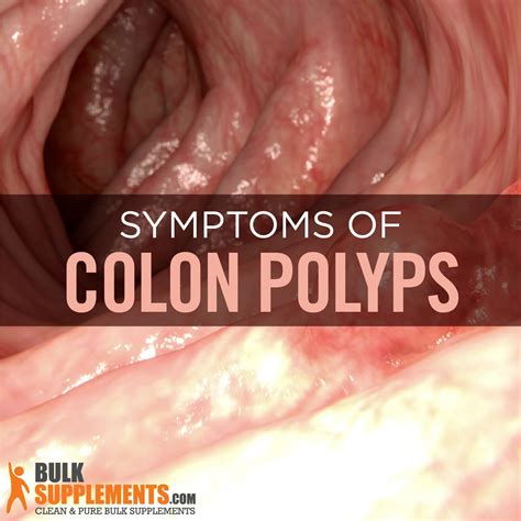 Depending on where the tumor is, symptoms of colorectal cancer include: Colon Polyps: Symptoms, Causes & Treatment - Science ...