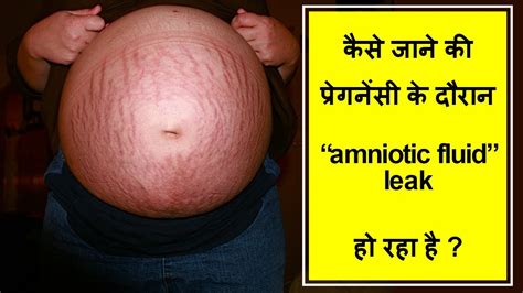 Signs Of Leaking Amniotic Fluid Vs Discharge Mytemilitary