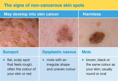 Skin Cancer Body Map