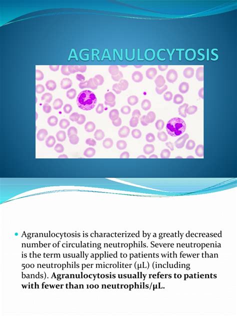 Agranulocytosis Final Pdf Infection Epidemiology