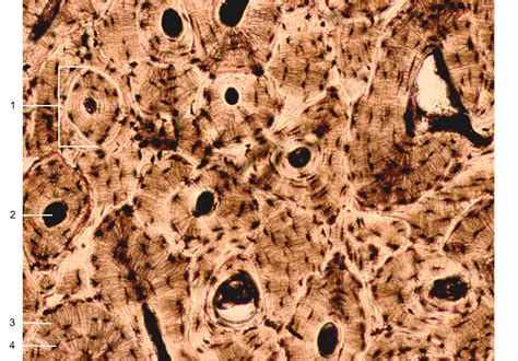 Osseous Tissue (Compact Bone) – Human Body Help