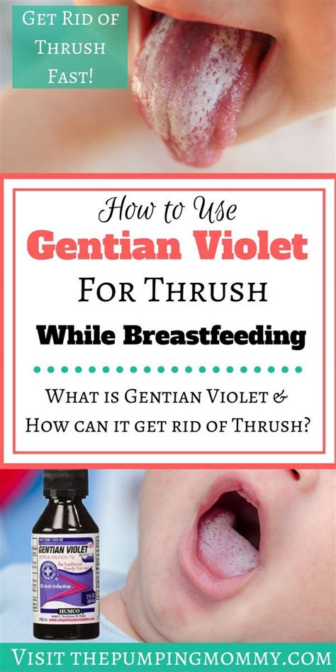 8 How To Use Gentian Violet For Thrush In Babies Ideas Babbiesf