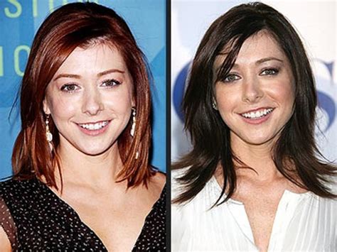 Alyson Hannigan Facelift Plastic Surgery Before And After Celebie