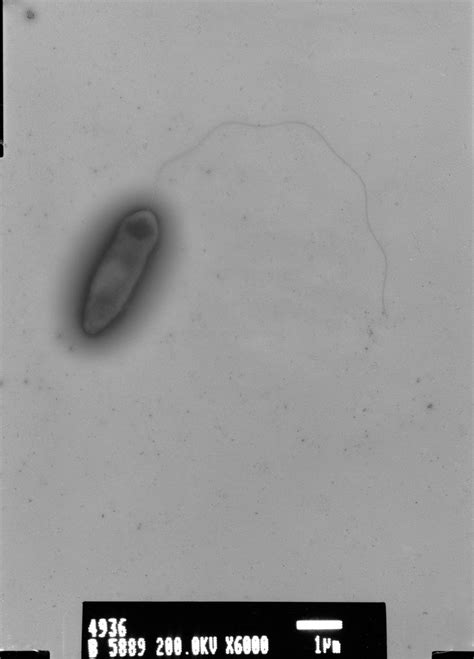 Ideonella Sakaiensis 000004150 Microbiology Biochemical Microbial