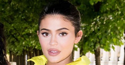 Kylie Jenner Shares The Story Behind Her Leg Scar