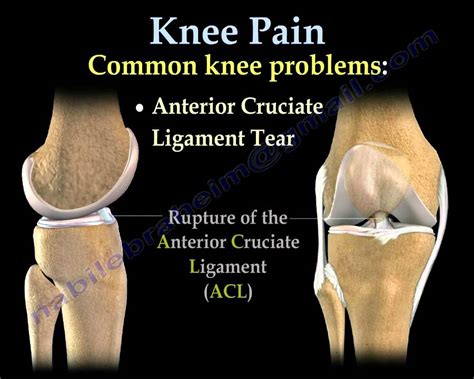 Why Does My Right Knee Hurt