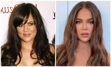 Khloé Kardashian reveals which plastic surgery she has done