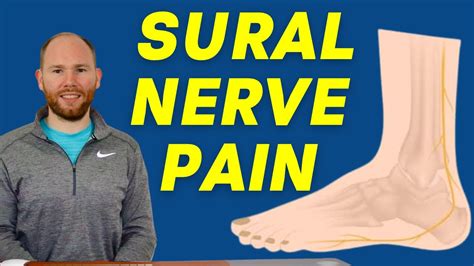 Sural Nerve Pain Diagnosis Treatment And Sural Nerve Glider