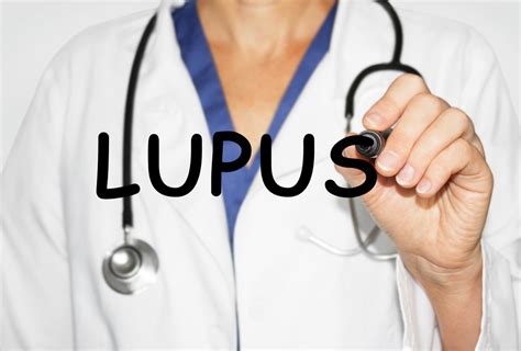 Immunovias Immray Differentiates Lupus From Other Autoimmune Diseases