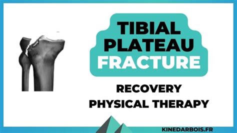 Tibial Plateau Fracture Recovery Time And Physical Therapy Tips