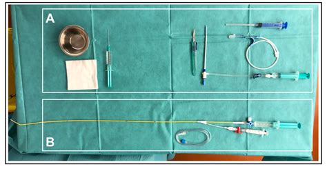 Measurement Of The Hepatic Venous Pressure Gradient And Transjugular