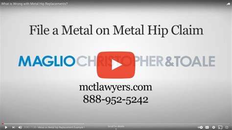 Depuy Asr Hip Recall News Metal On Metal Hip Recall Lawyer