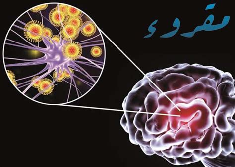هل يمكن الشفاء من كهرباء المخ عند الكبار
