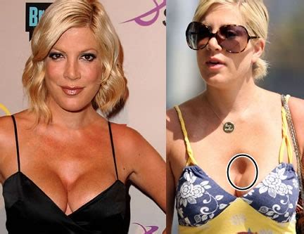 Tori Spelling Plastic Surgery Gone Wrong Before And After Pictures