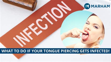 Infected Tongue Piercing 4 Common Causes And Ways To Avoid It Marham