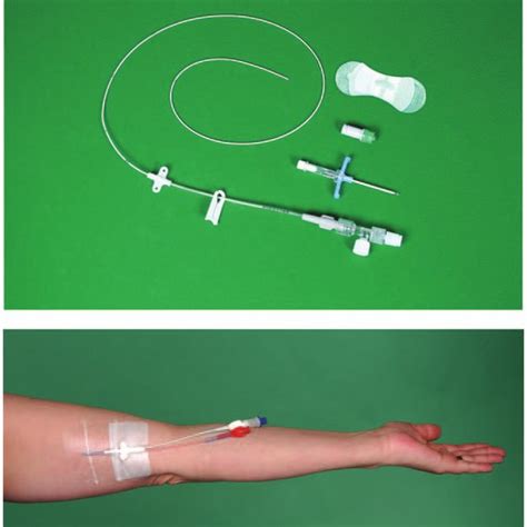 A Peripherally Inserted Central Catheter Picc B Peripherally