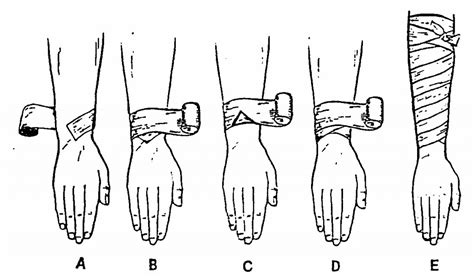 Figure 2 26 Applying A Spiral Bandage To A Forearm Tactical Combat