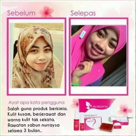 Guna skincare yang sama setiap hari. gedempol itu rare: NURRAYSA BEAUTY SKINCARE