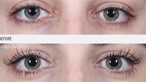 We did not find results for: Do Eyelashes Grow Longer? - beLASHED