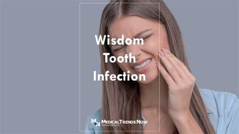 What Causes A Wisdom Tooth Infection And How To Treat Pericoronitis