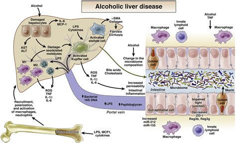 Gutliver Axis In Alcoholic Liver Disease Gastroenterology