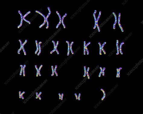 Turner S Syndrome Karyotype Illustration Stock Image F016 3489