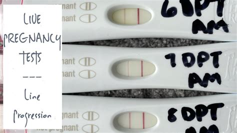 Ivf Round 2 Live Pregnancy Tests 7 8 Dp5dt Tww Symptoms Becoming