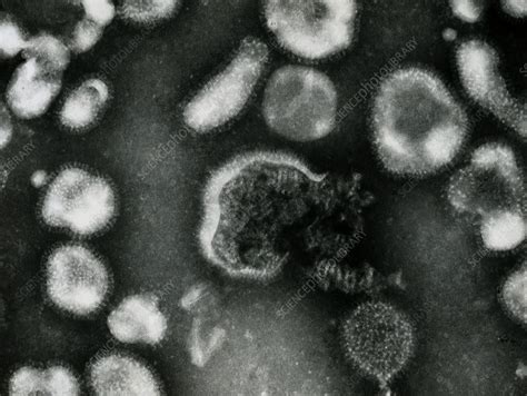 Electron Micrograph Of Avian Influenza Viruses Stock Image M055