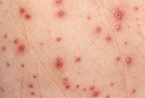 Red Spots On Skin Not Itchy 17 Causes Treatments Home