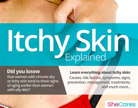 Dry And Itchy Skin Shecares
