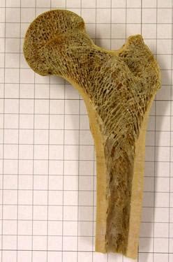 Two types of bone tissues in cross section of a long bone : An Inside Look | Smithsonian National Museum of Natural ...