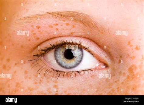 Closeup Of An Female Eye With Freckles Around It Stock Photo Alamy