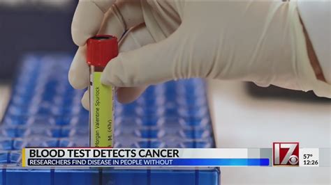 Blood Test Detects Cancer Youtube