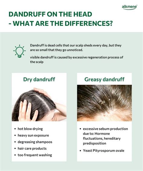 Dandruff Cosmetic Problem Or Skin Disease Alkmene