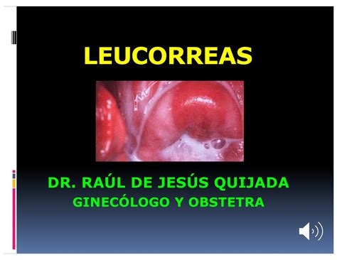 Calam O Leucorreas E Infecciones