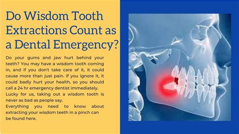 Do Wisdom Tooth Extractions Count As A Dental Emergency By Road Dental