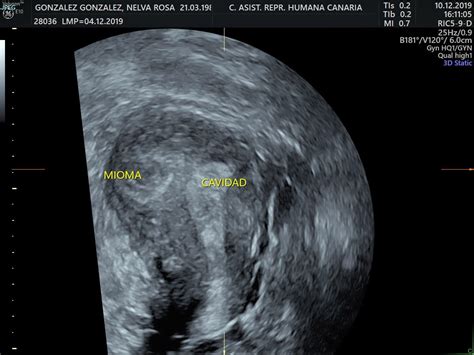 Simple Science: How to Make a Volcano with Kids