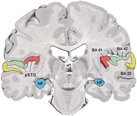 Auditory Cortex Language Recognition Neuroscience News