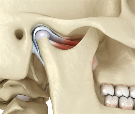 Temporomandibular Joint Disorders (TMDs) - Revise Dental