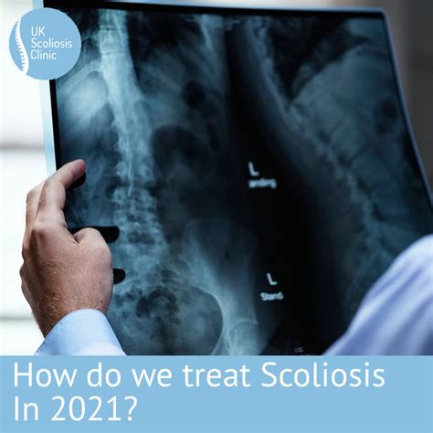 How Is Scoliosis Treated In 2021 Scoliosis Clinic Uk Treating