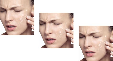 Sensitive Skin Panorama Dermatology Clinic