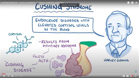 Paramedic Cushing Syndrome