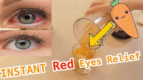How To Relieve Red Eyes Fast With No Eye Drops 快速減緩眼部疲勞 Simple Red