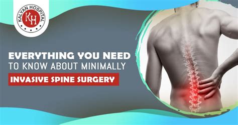 Everything You Need To Know About Minimally Invasive Spine Surgery