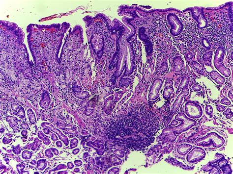 Gastrointestinal And Liver Histology Pathology Atlas Stomach Gastric