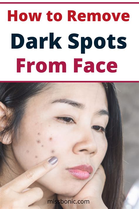 How To Remove Dark Spots From Face Remove Dark Spots Acne Dark